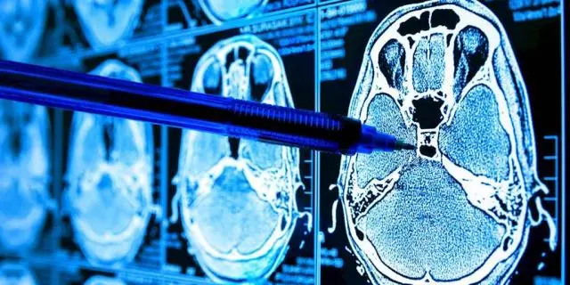 淘丁科普：数据标注在智慧医疗中的应用插图2