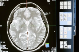 PANDA创造生命奇迹背后，医疗数据标注如何成为AI的“火眼金睛”？缩略图